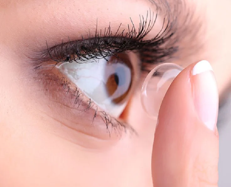 Adaptation en lentilles de contact