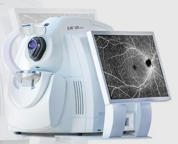 Tomographie en cohérence optique (OCT)